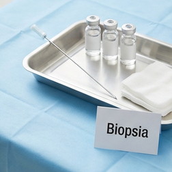 Il viagra può essere efficace dopo un intervento chirurgico alla prostata o una biopsia per il cancro?